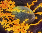 SARS-CoV_scanning_electron_microscope_image